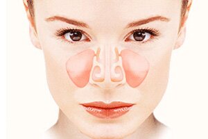 Что такое гайморит