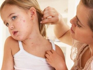 Кожная сыпь у детей.