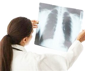 Хроническая обструктивная болезнь легких при беременности